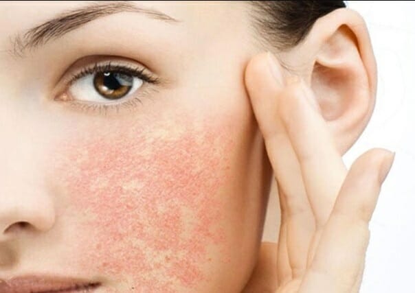 Vi kim tảo biển nano